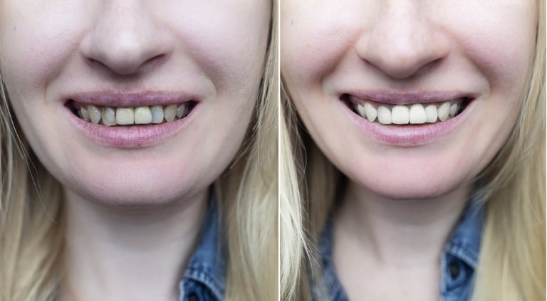 Before and after restoration